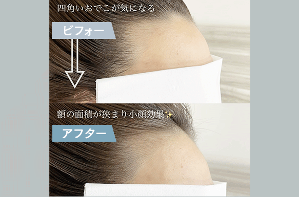 ビフォーアフター1