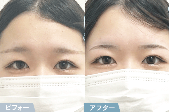 ビフォーアフター3