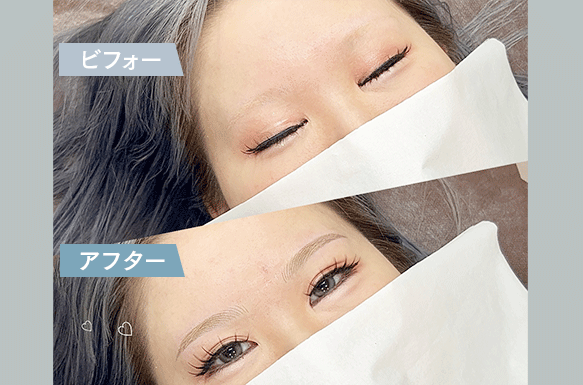 ビフォーアフター4