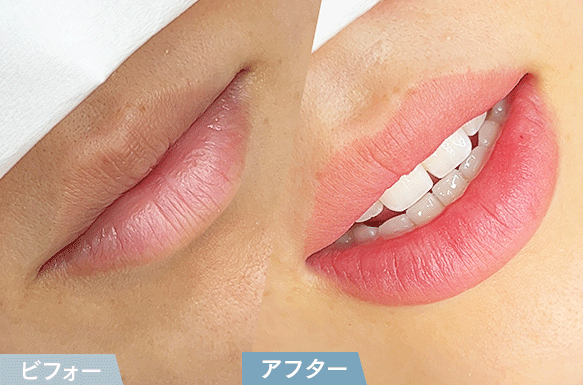ビフォーアフター5